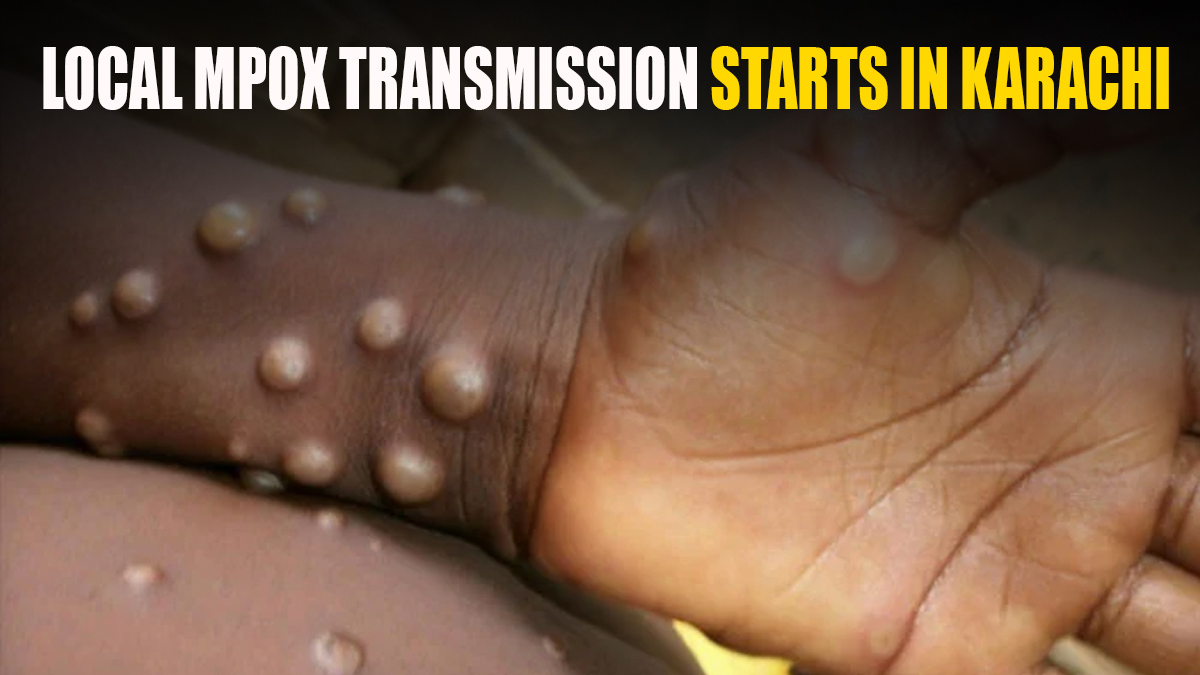 “CHILDREN IN DANGER: VIRUS OUTBREAK SHOCKS KARACHI!”